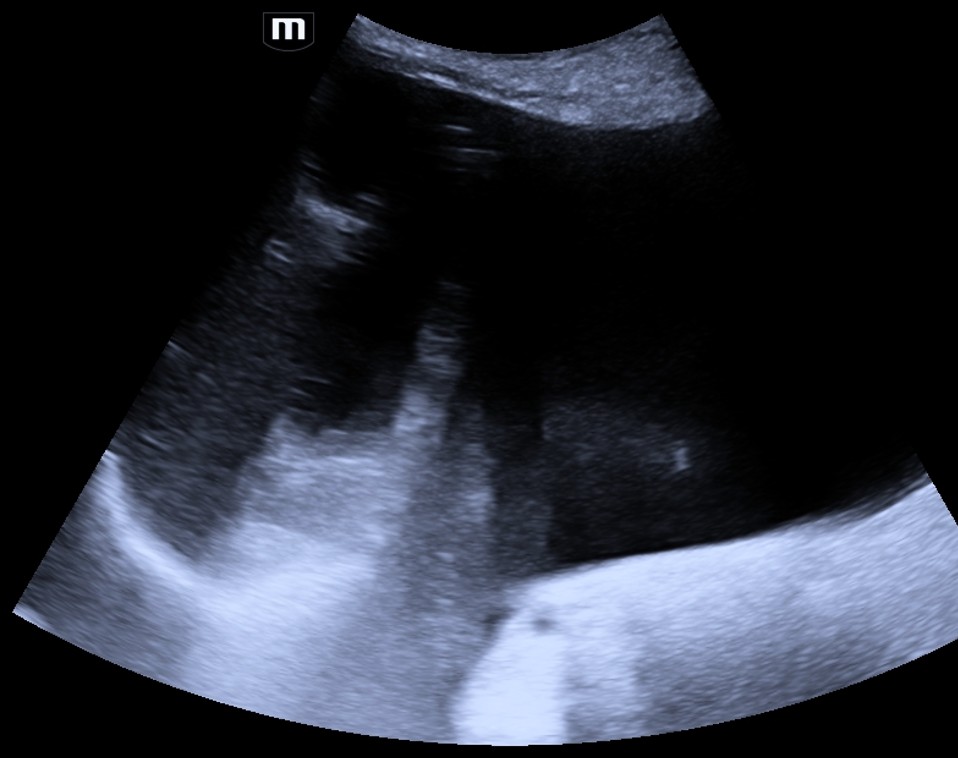 Ilustração: Fatores técnicos impedem avaliação adequada