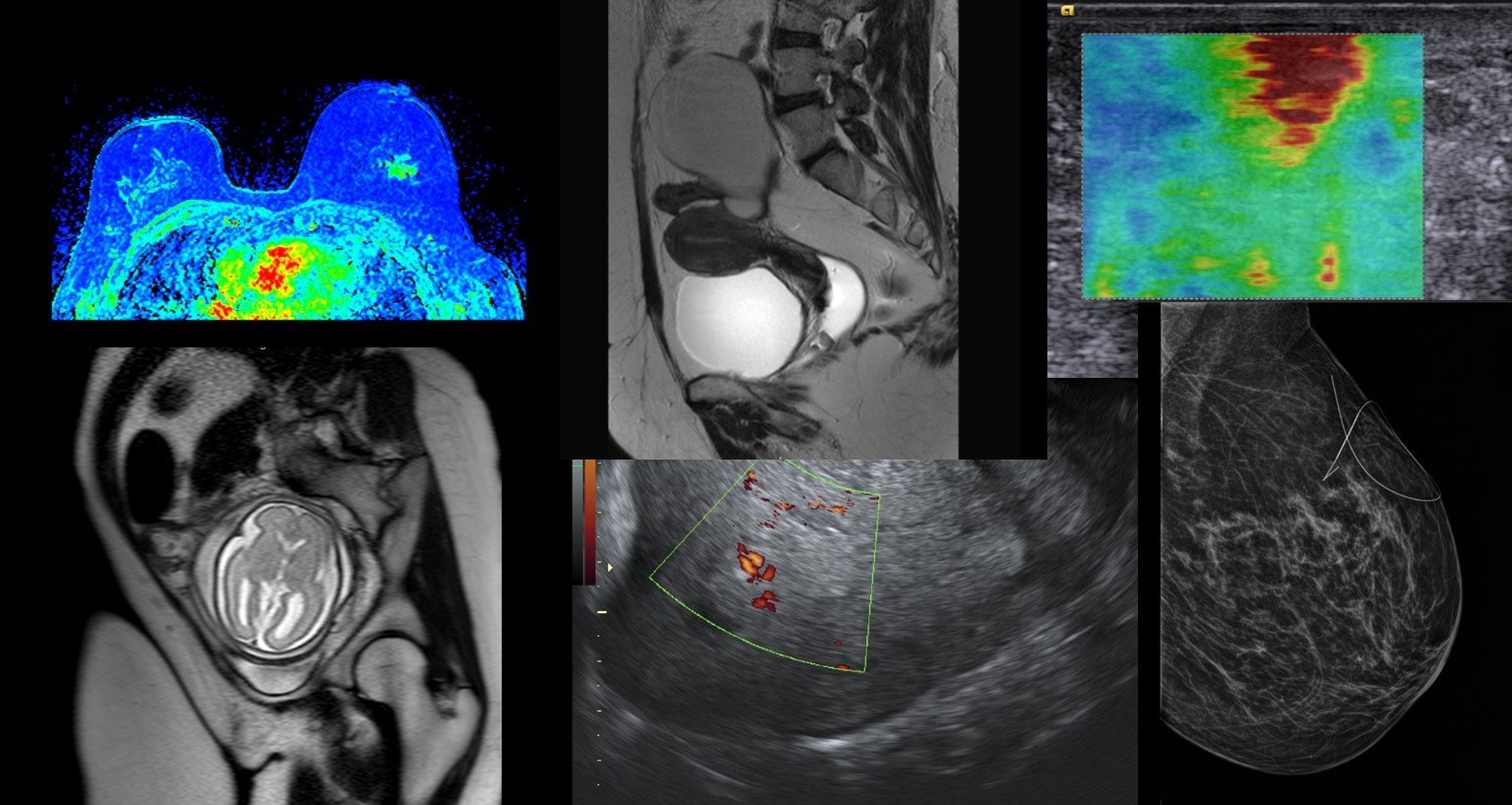 Montagem de exames de imagem da mulher — ressonância magnética mamária, pélvica e fetal, ultrassonografia com Doppler, elastografia e mamografia